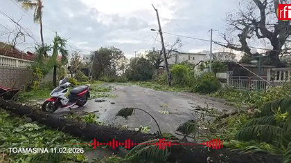 Illustration le sous-développement tue