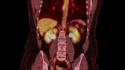 Illustration Coup de force au CHD